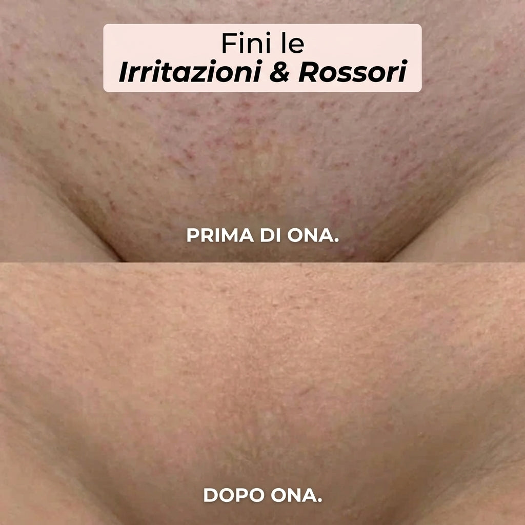 Rasoio Elettrico 2 in 1 Donna – Bikini e Corpo ONA™